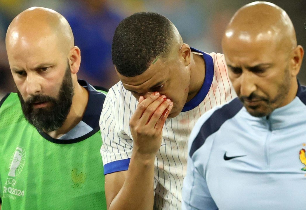 Kylian Mbappe de Francia sale con la nariz rota en el partido del grupo D de la Eurocopa 2024 entre Austria y Francia, en Dusseldorf (Alemania) EFE/EPA/FRIEDEMANN VOGEL